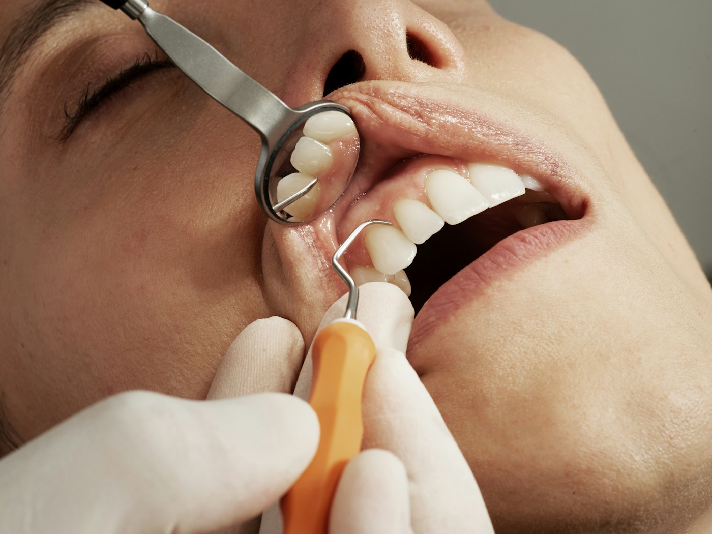 Patient receiving a preventive dental examination